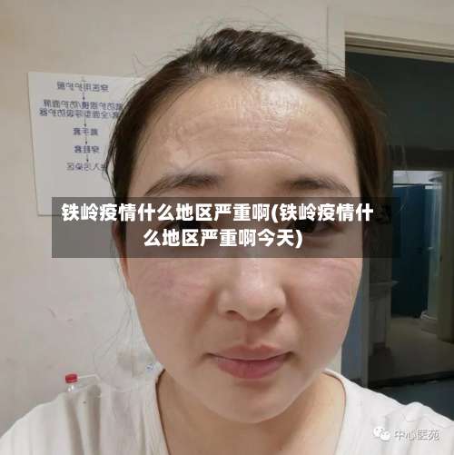 铁岭疫情什么地区严重啊(铁岭疫情什么地区严重啊今天)-第3张图片