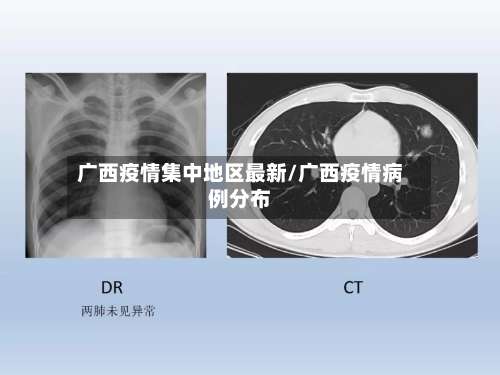 广西疫情集中地区最新/广西疫情病例分布-第2张图片
